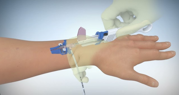 ARROW ENDURANCE Extended Dwell Peripheral Catheter System - For Practice Use