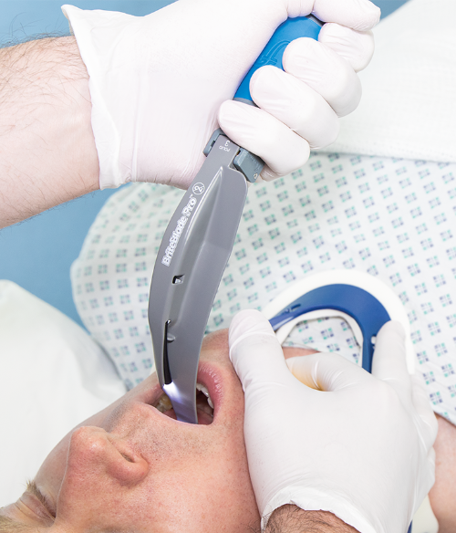 A person is being intubated with a Mac 4 laryngoscope blade which is attached to a fiber-optic handle, held by a healthcare professional.