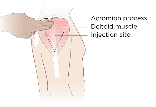 Intramuscular (IM) Injection Training Model
